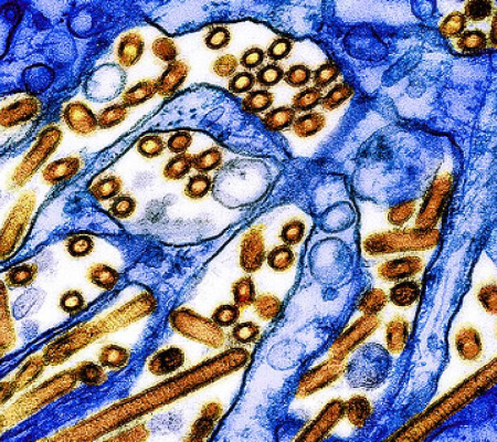 ABD ve Kanada'da Son Zamanlarda Görülen H5N1’e Bağlı İnsan Hastalıklarının Klinik Tablosu Netleştiriyor