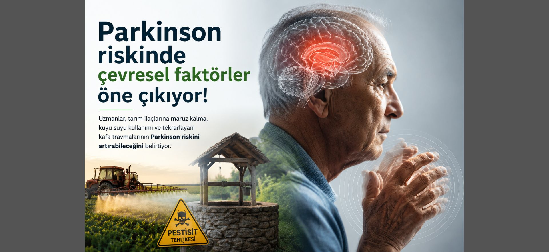 Parkinson Riskinde Çevresel Faktörler Öne Çıkıyor parkinson hastalığı, parkinson riski, çevresel faktörler, nörodejeneratif hastalıklar, çevresel maruziyet, beyin sağlığı